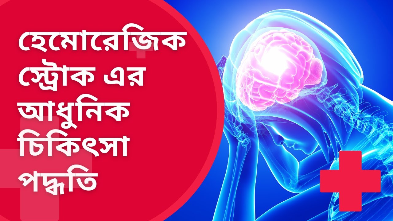 modern treatments of hemorrhagic stroke