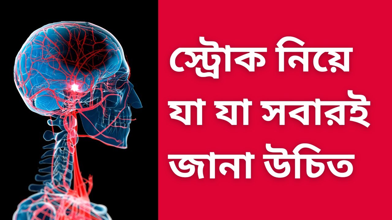 what everyone needs to know about stroke